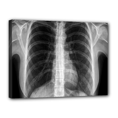 X Ray Canvas 16  x 12 