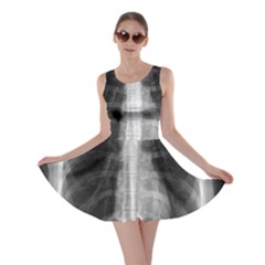 X Ray Skater Dress