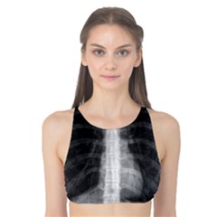 X Ray Tank Bikini Top