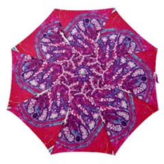Histology Inc Histo Logistics Incorporated Masson s Trichrome Three Colour Staining Straight Umbrellas by Mariart