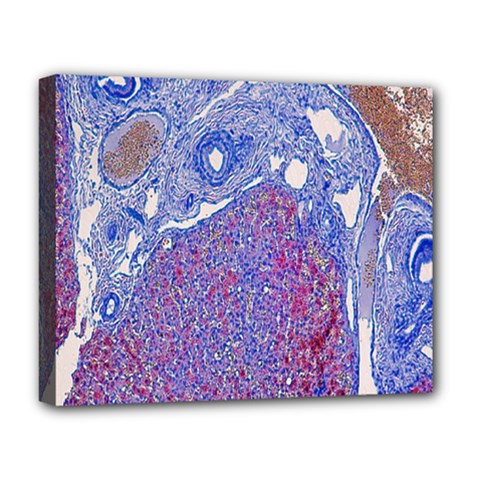 Histology Inc Histo Logistics Incorporated Human Liver Rhodanine Stain Copper Deluxe Canvas 20  X 16  