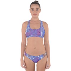 Histology Inc Histo Logistics Incorporated Human Liver Rhodanine Stain Copper Cross Back Hipster Bikini Set by Mariart