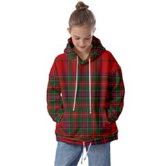 Stewart Of Rothesay Kids  Oversized Hoodie by tartantotartansallreddesigns