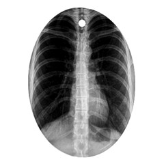 X Ray Ornament (Oval)
