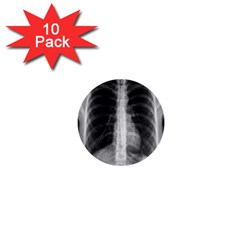 X Ray 1  Mini Buttons (10 pack) 