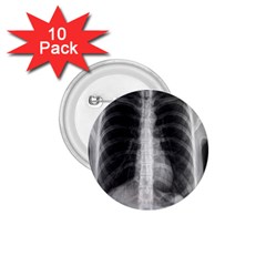 X Ray 1.75  Buttons (10 pack)