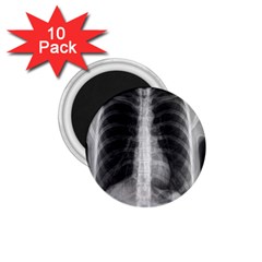 X Ray 1.75  Magnets (10 pack) 