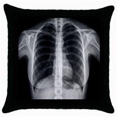 X Ray Throw Pillow Case (Black)