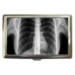 X Ray Cigarette Money Cases