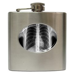 X Ray Hip Flask (6 oz)