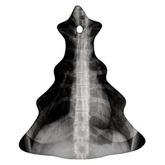 X Ray Christmas Tree Ornament (Two Sides)