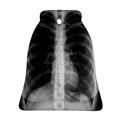 X Ray Bell Ornament (Two Sides)