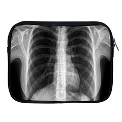 X Ray Apple iPad 2/3/4 Zipper Cases