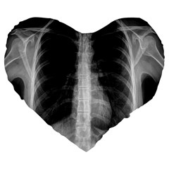 X Ray Large 19  Premium Flano Heart Shape Cushions