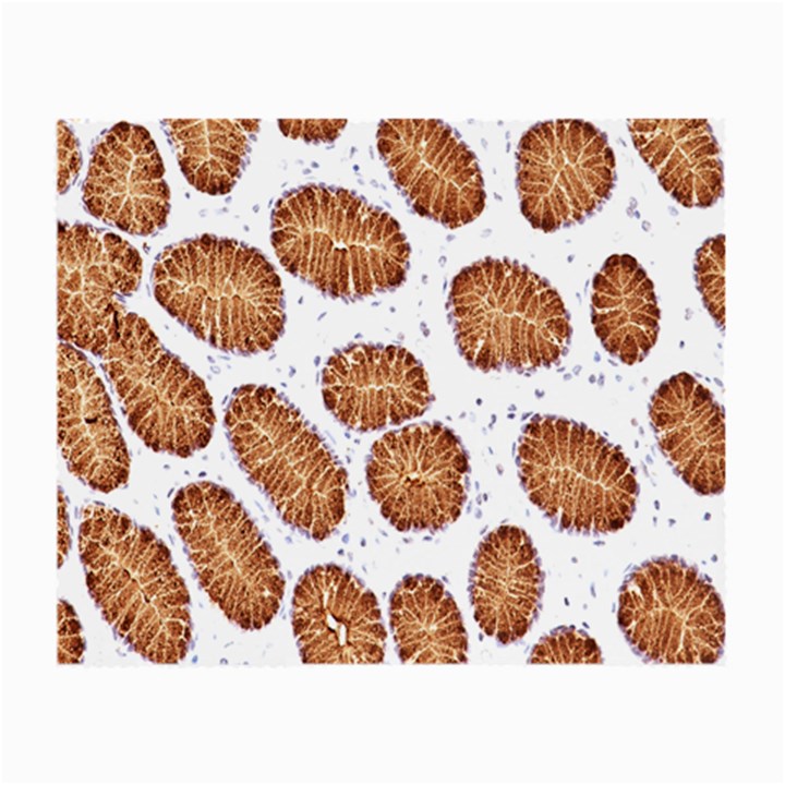 Formalin Paraffin Human Stomach Stained Bacteria Brown Small Glasses Cloth (2-Side)