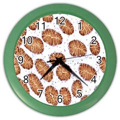 Formalin Paraffin Human Stomach Stained Bacteria Brown Color Wall Clocks