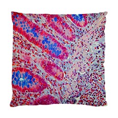 Histology Inc Histo Logistics Incorporated Alcian Blue Standard Cushion Case (one Side) by Mariart