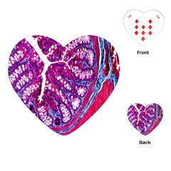 Histology Inc Histo Logistics Incorporated Masson s Trichrome Three Colour Staining Playing Cards (heart)  by Mariart