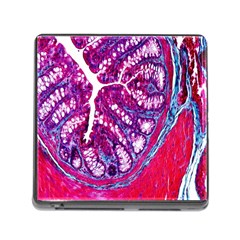 Histology Inc Histo Logistics Incorporated Masson s Trichrome Three Colour Staining Memory Card Reader (square)