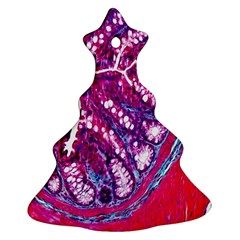 Histology Inc Histo Logistics Incorporated Masson s Trichrome Three Colour Staining Ornament (christmas Tree)  by Mariart