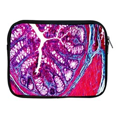 Histology Inc Histo Logistics Incorporated Masson s Trichrome Three Colour Staining Apple Ipad 2/3/4 Zipper Cases by Mariart