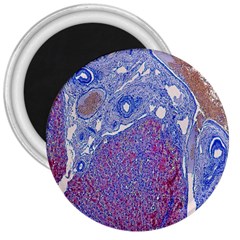 Histology Inc Histo Logistics Incorporated Human Liver Rhodanine Stain Copper 3  Magnets by Mariart