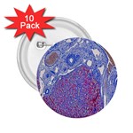 Histology Inc Histo Logistics Incorporated Human Liver Rhodanine Stain Copper 2.25  Buttons (10 pack)  Front