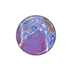 Histology Inc Histo Logistics Incorporated Human Liver Rhodanine Stain Copper Hat Clip Ball Marker (4 Pack)