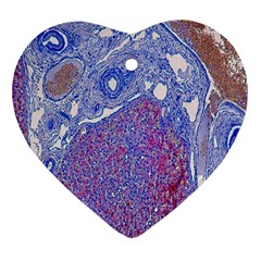 Histology Inc Histo Logistics Incorporated Human Liver Rhodanine Stain Copper Heart Ornament (two Sides)