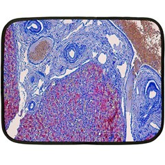 Histology Inc Histo Logistics Incorporated Human Liver Rhodanine Stain Copper Double Sided Fleece Blanket (mini) 