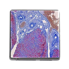 Histology Inc Histo Logistics Incorporated Human Liver Rhodanine Stain Copper Memory Card Reader (square)