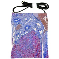 Histology Inc Histo Logistics Incorporated Human Liver Rhodanine Stain Copper Shoulder Sling Bags by Mariart