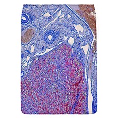 Histology Inc Histo Logistics Incorporated Human Liver Rhodanine Stain Copper Flap Covers (s) 