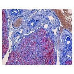 Histology Inc Histo Logistics Incorporated Human Liver Rhodanine Stain Copper Double Sided Flano Blanket (medium)  by Mariart