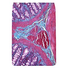 Natural Stone Red Blue Space Explore Medical Illustration Alternative Flap Covers (s)  by Mariart