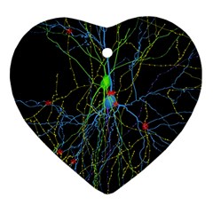 Synaptic Connections Between Pyramida Neurons And Gabaergic Interneurons Were Labeled Biotin During Heart Ornament (two Sides)