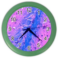 The Luxol Fast Blue Myelin Stain Color Wall Clocks